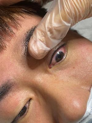 Permanent eyeliner